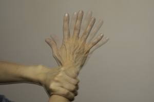 Essential Tremor or Parkinson’s?