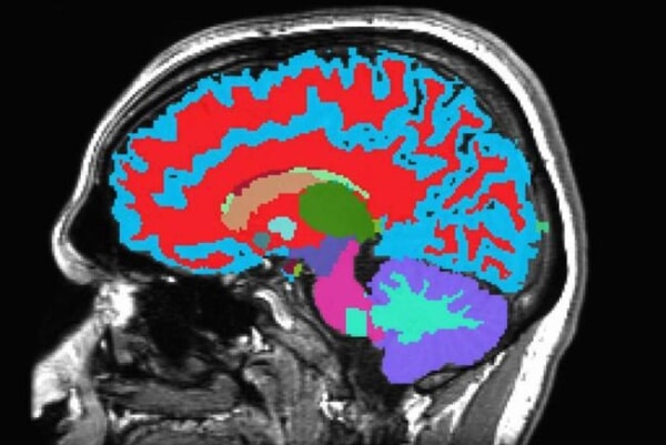 A Single Brain Scan May Predict How Fast You’re Aging, NIH Study Finds