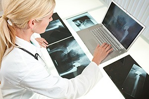 Women More Likely to Experience Hip, Knee, and Feet Pain